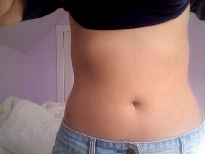 El resultado del tratamiento con cápsulas de NEOflorax.