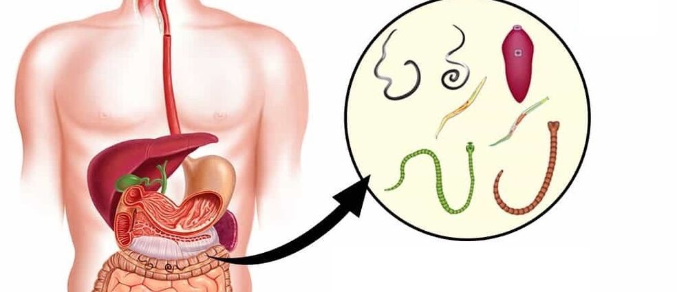 Parásitos en el cuerpo humano.