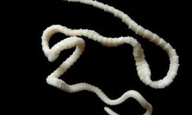 cómo eliminar el parásito cestodo del cuerpo