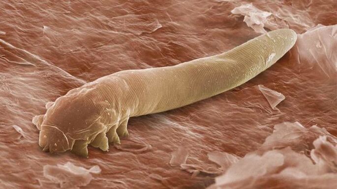 Parásito subcutáneo bajo un microscopio.