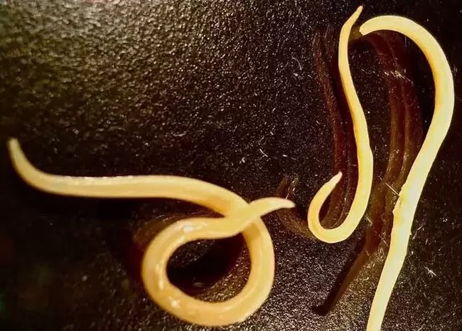 parásito protozoario del cuerpo humano